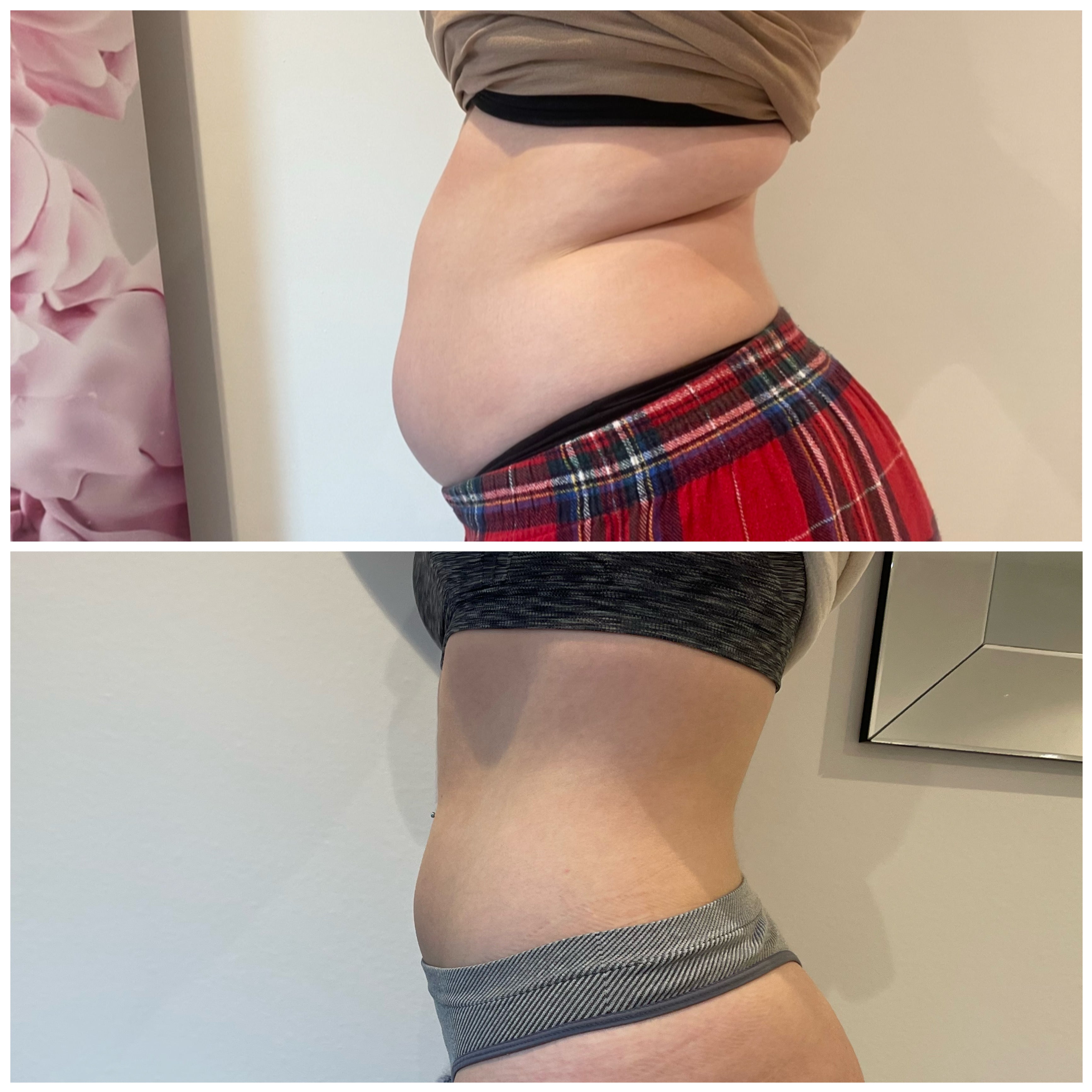 Two images showing a person's waist area shrinking.