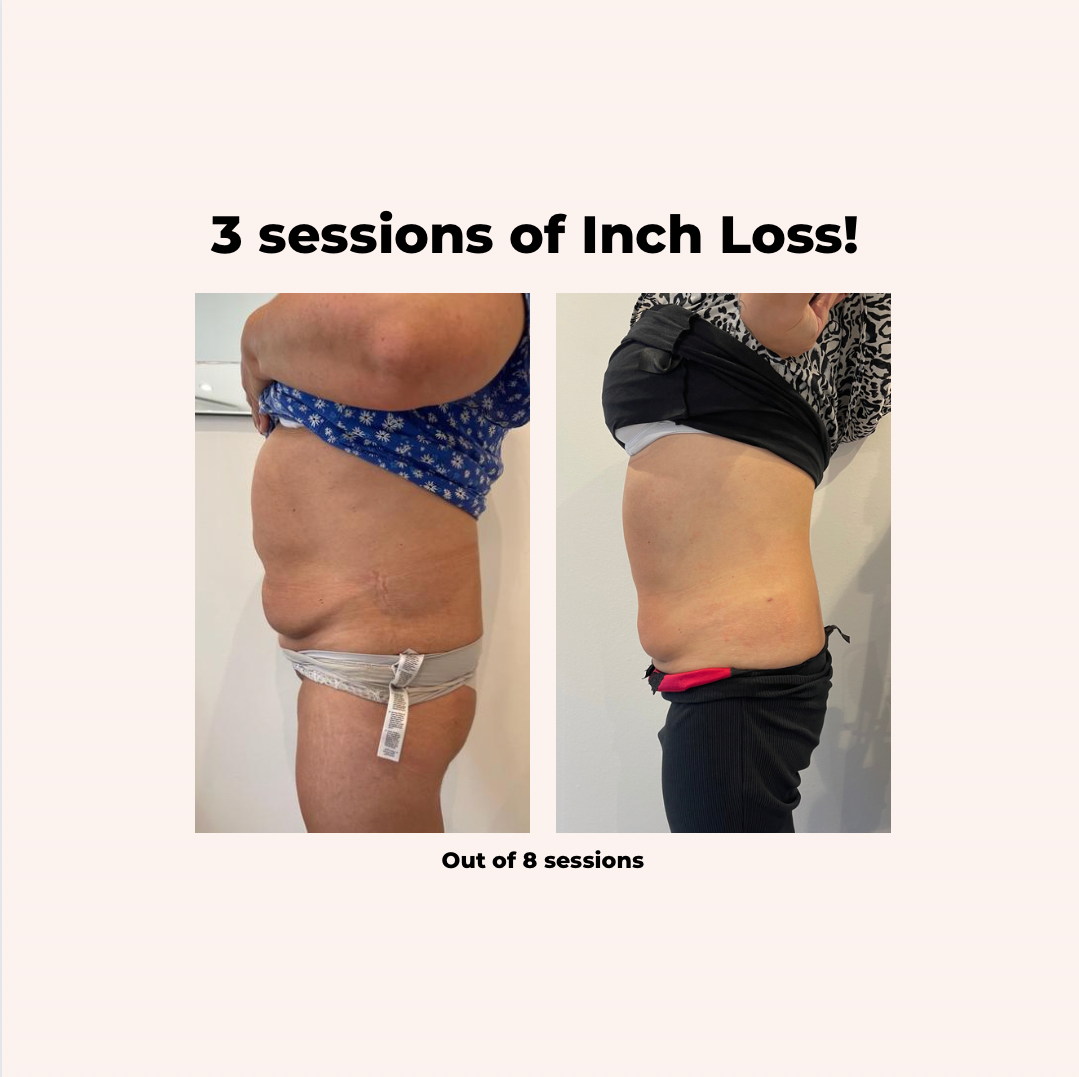 Ultimate Tummy Inch Loss - Female