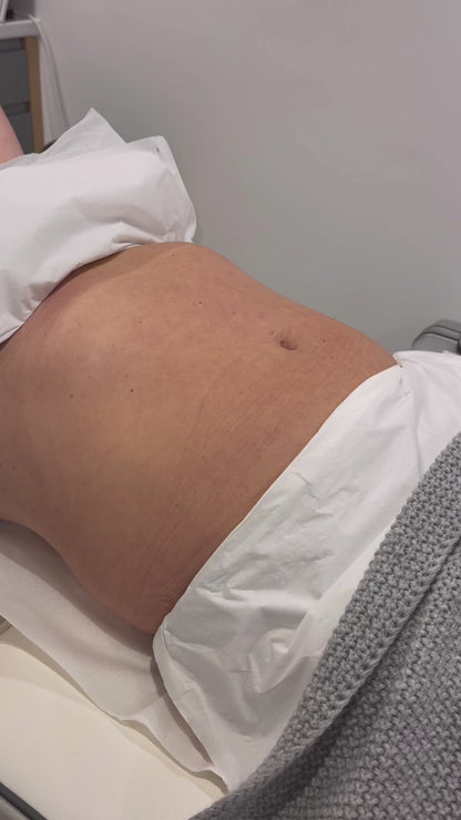 Ultimate Tummy Inch Loss - Female Package