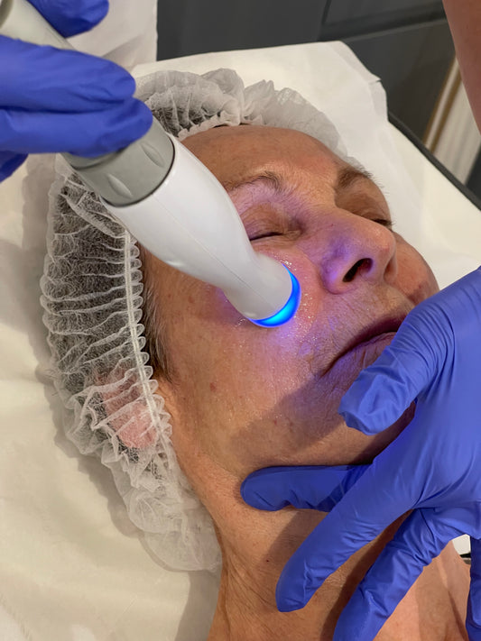 Radio Frequency Skin- Tightening Face and Neck Treatment