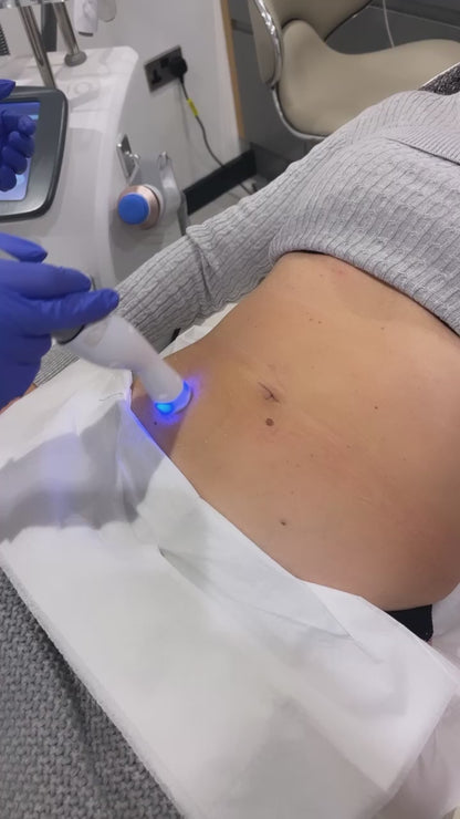 Body Skin-Tightening Package